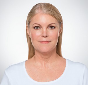 Kybella