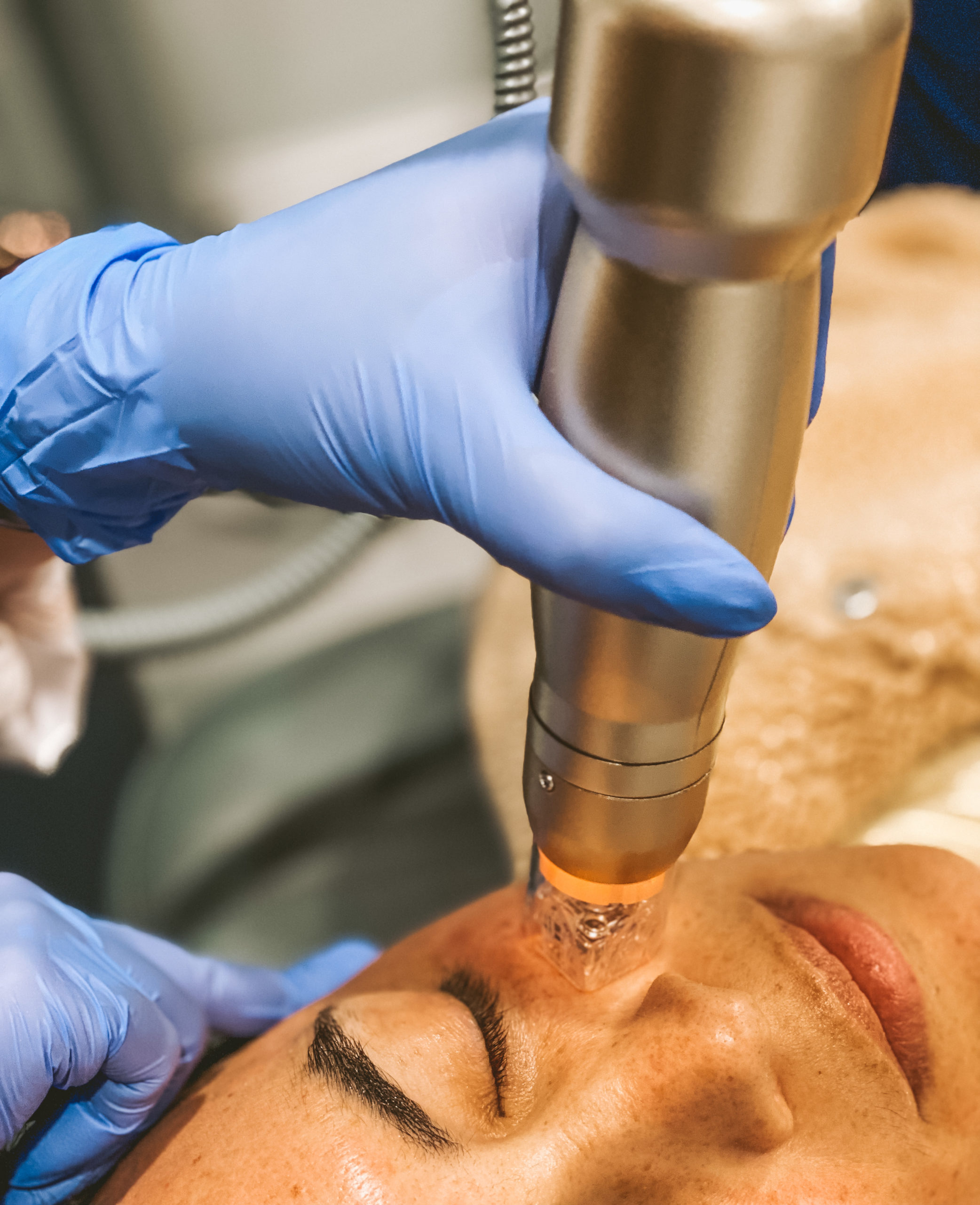 microneedling-device-scaled-1.jpg microneedling-device-scaled-1.jpg