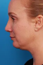 6298-89115-150x225.jpg