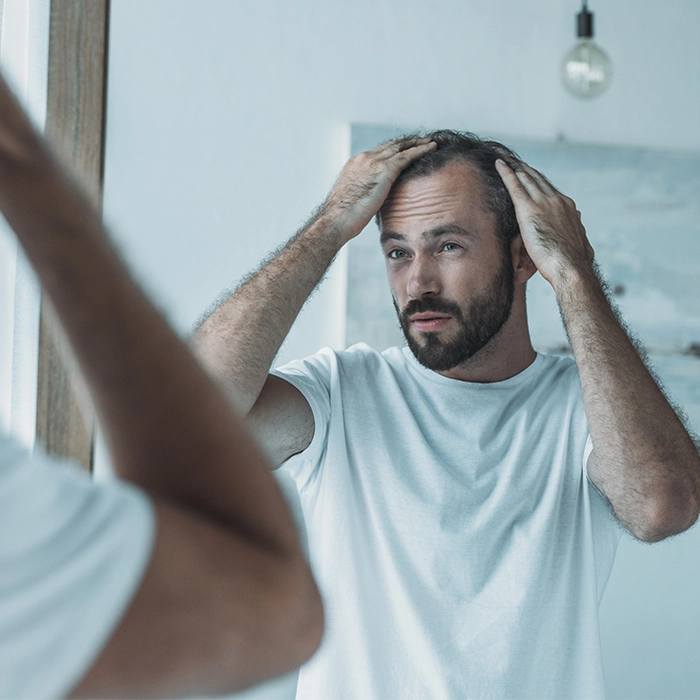 Hair Restoration good candidate Hair Restoration good candidate