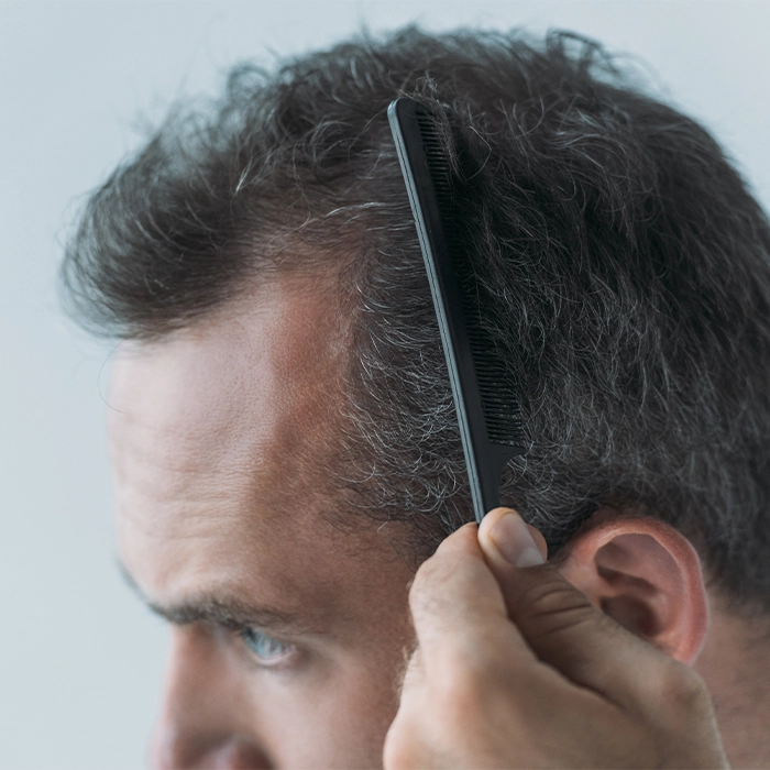 Hair Restoration Hair Restoration