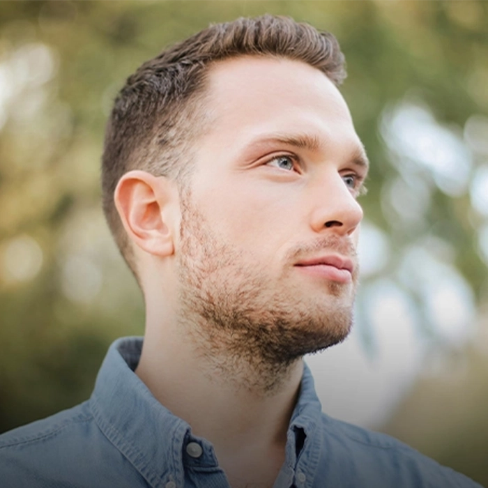 PRP Hair Restoration Side 4 PRP Hair Restoration Side 4