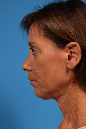 7191-92842