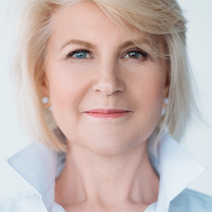 Blepharoplasty side 1 Blepharoplasty side 1