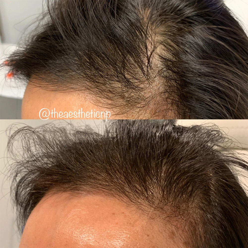 hair-restoration-ca-2.webp